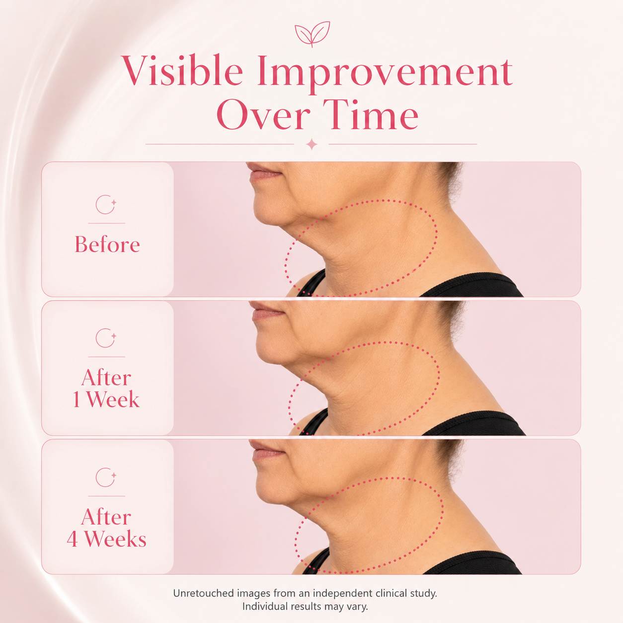 Femmekin NAD+ Anti-Aging Cream for Youthful Skin