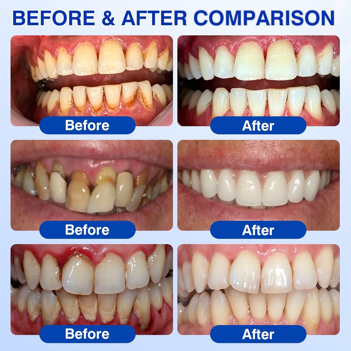 Femmekin Periodontal Repair Gel