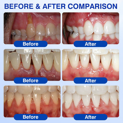 Femmekin Periodontal Repair Gel