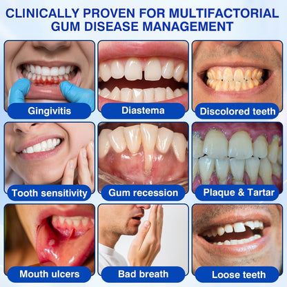 Femmekin Periodontal Repair Gel