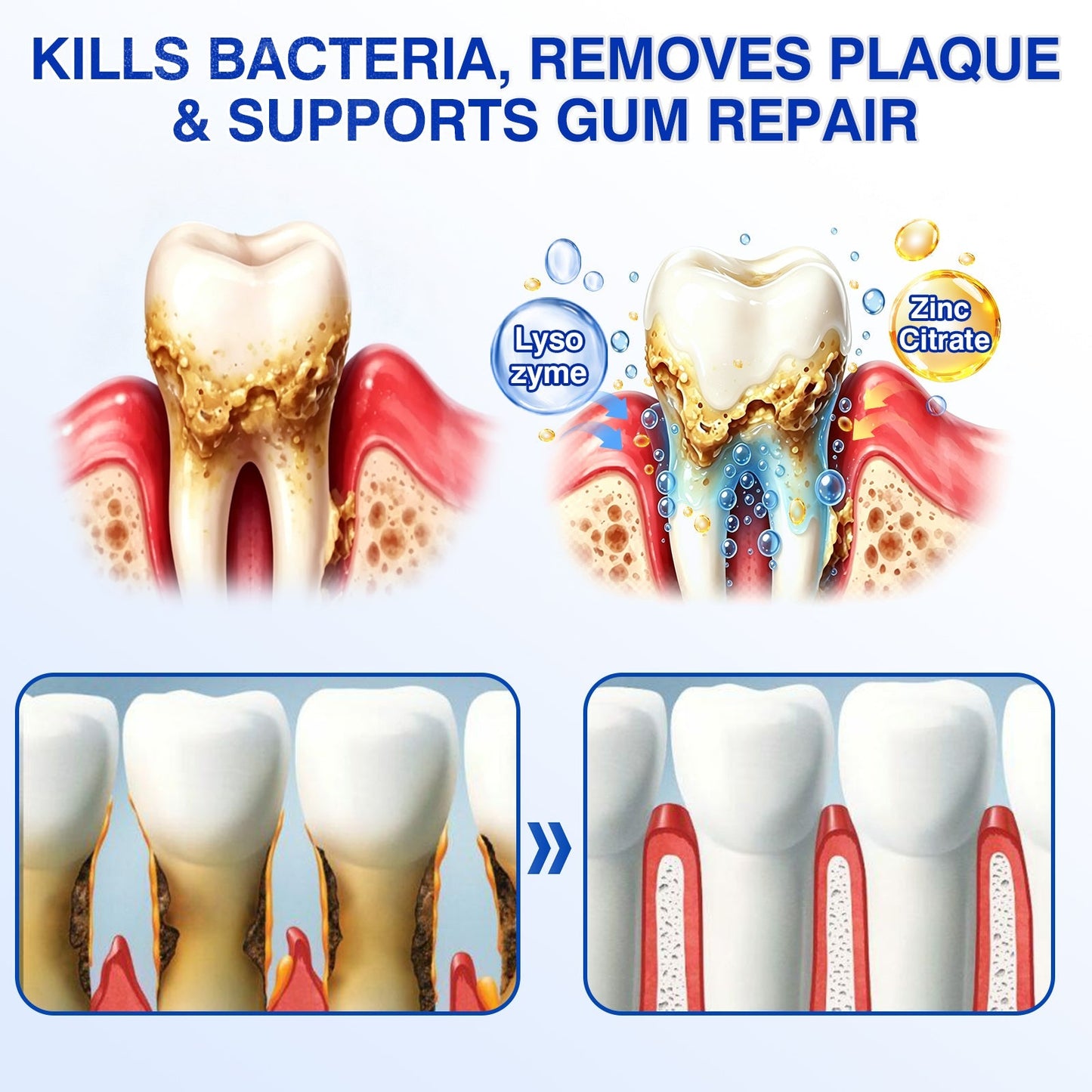Femmekin Periodontal Repair Gel
