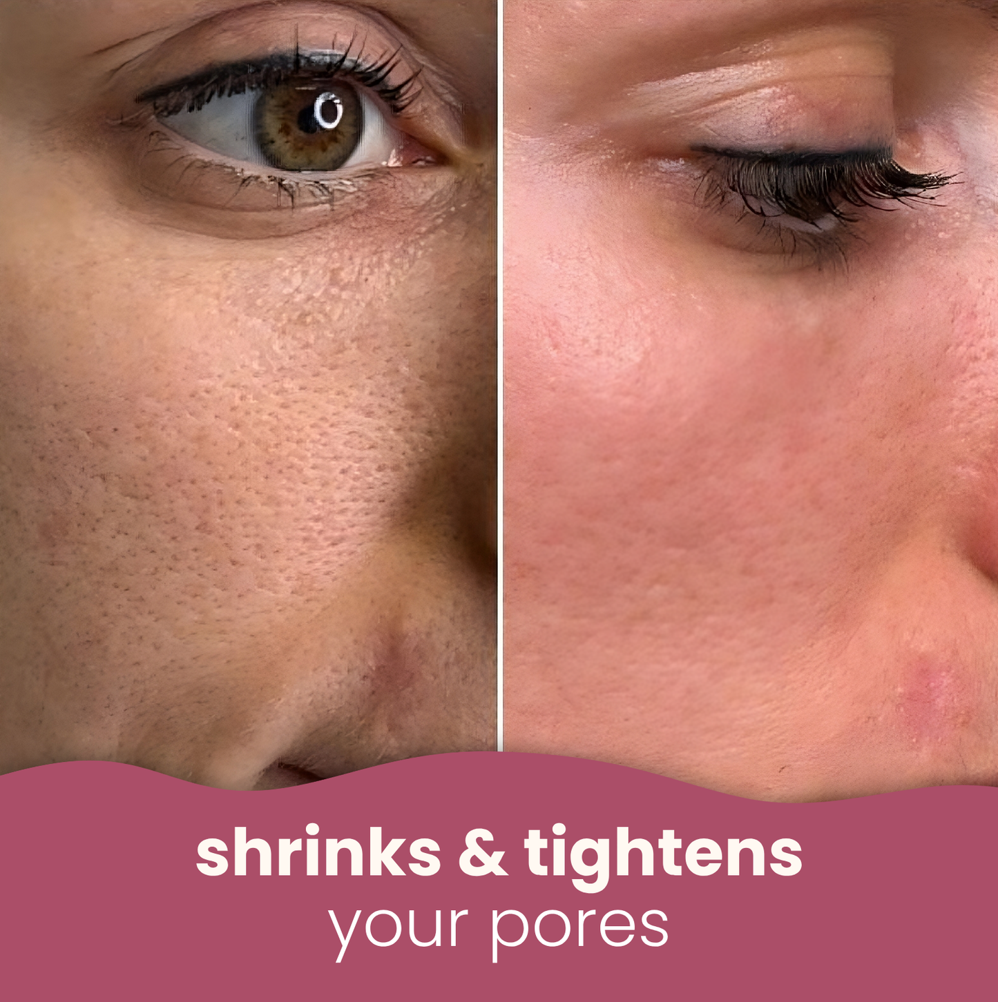 Brightening turmeric & kojic acid pads