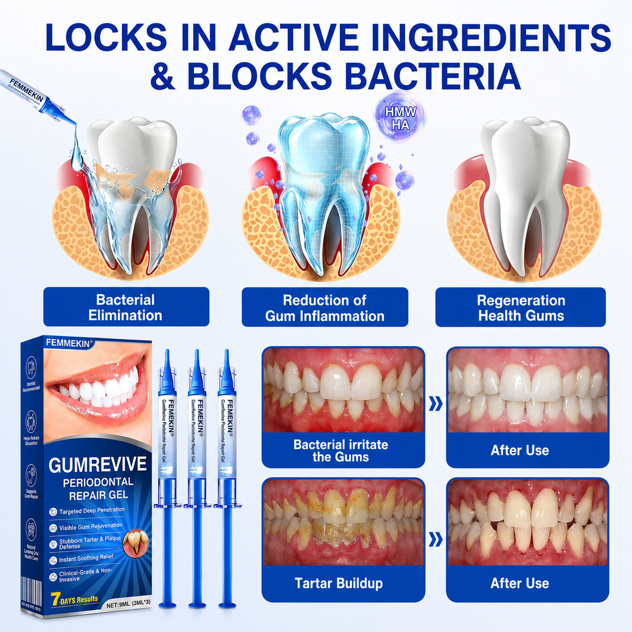 Femmekin Periodontal Repair Gel