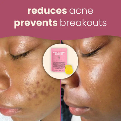 Brightening turmeric & kojic acid pads