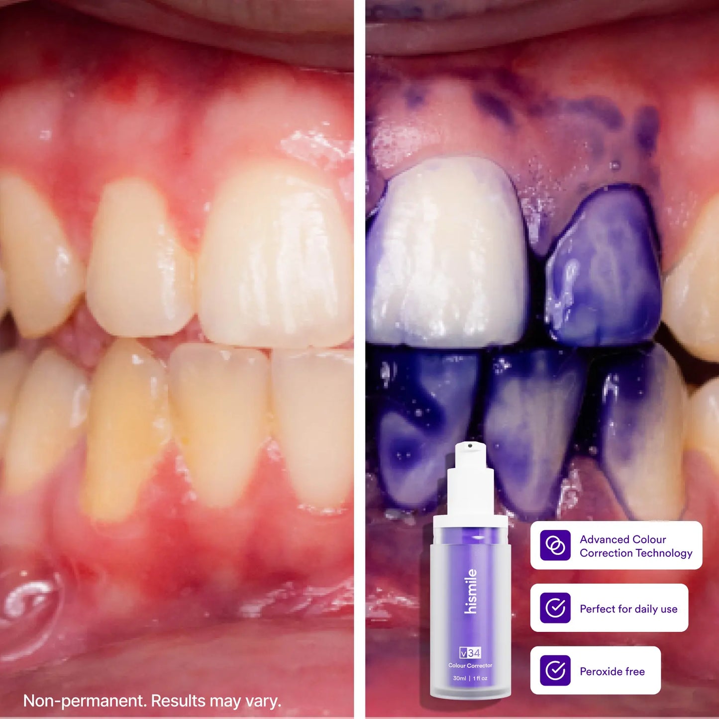 Hismile V34 Colour Corrector - Teeth Brightening Booster