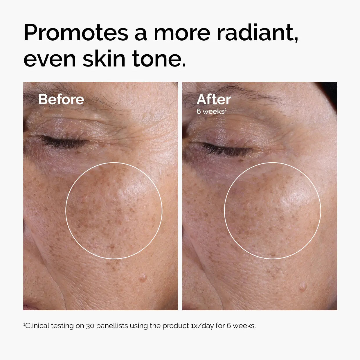 The Ordinary Glycolic Acid 7% Exfoliating Toner for Brightening Skin