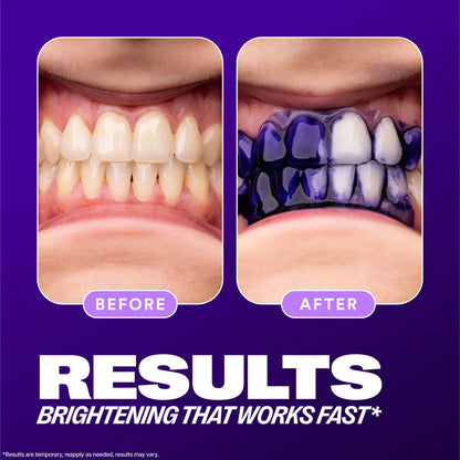 Hismile V34 Colour Corrector - Teeth Brightening Booster