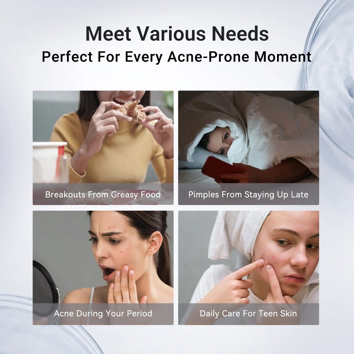 24H Acne & Pimple Treatment Lotion - Fast Relief