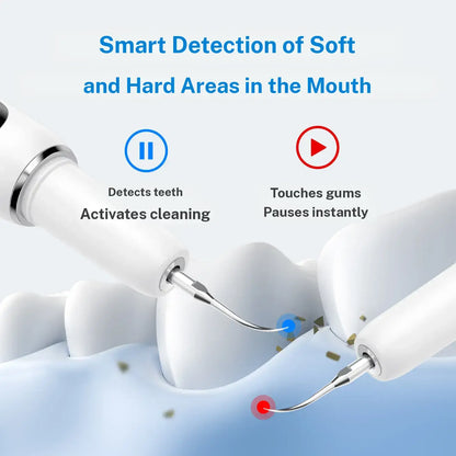 Femmekin Ultrasonic Plaque & Tartar Remover Kit