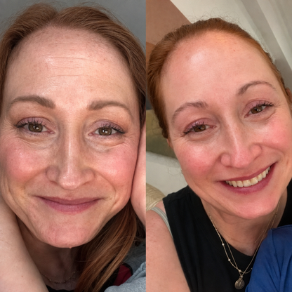 LIMITED-TIME 50% OFF❤️ Femmekin™ Firming & Renewal Retinol Peptide Duo