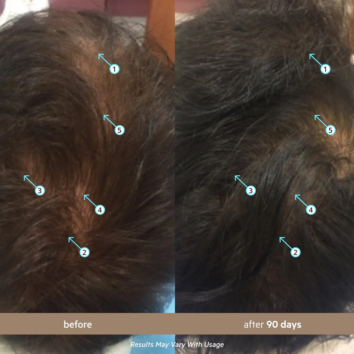 Men's Hair Density Serum with 5% Nanoxidil | Hair Growth & Thicker Looking Hair
