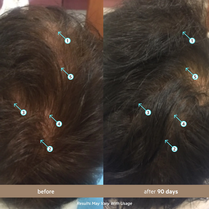 Men's Hair Density Serum with 5% Nanoxidil | Hair Growth & Thicker Looking Hair