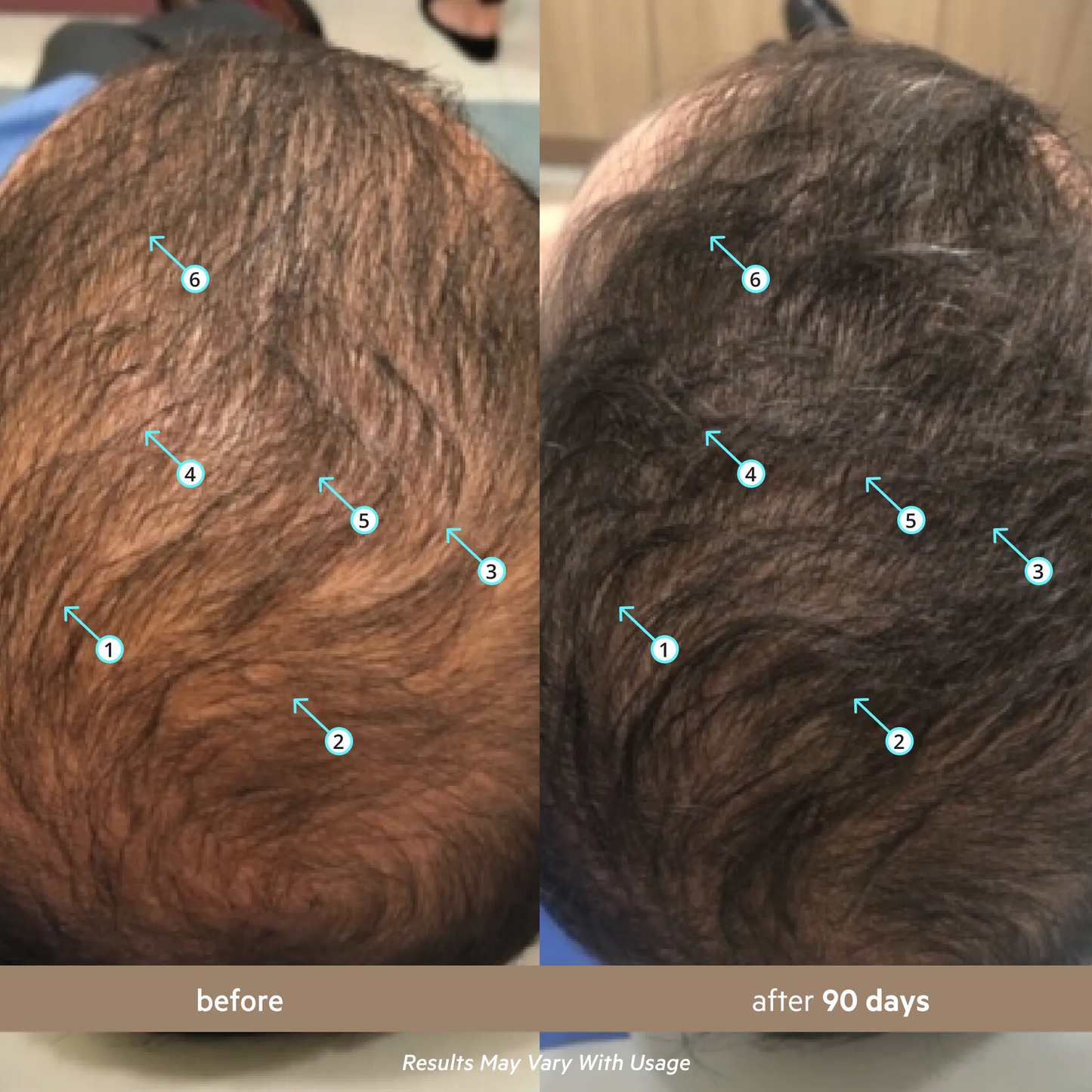 Men's Hair Density Serum with 5% Nanoxidil | Hair Growth & Thicker Looking Hair
