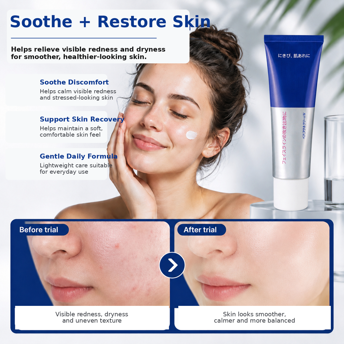 Acne Treatment Cream for Pimples and Blemish Care