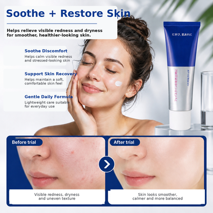 Acne Treatment Cream for Pimples and Blemish Care
